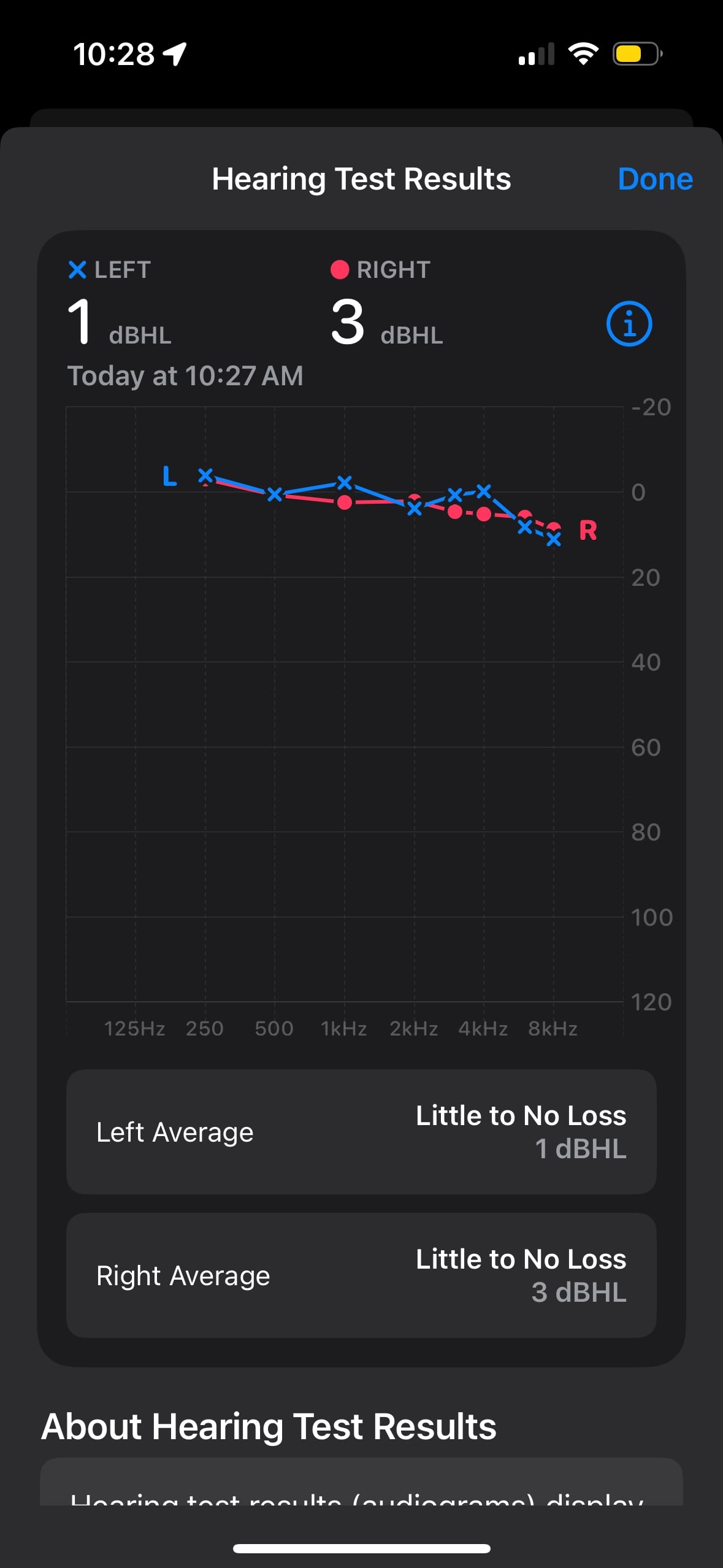 The AirPods Pro 2 hearing test audiogram chart.